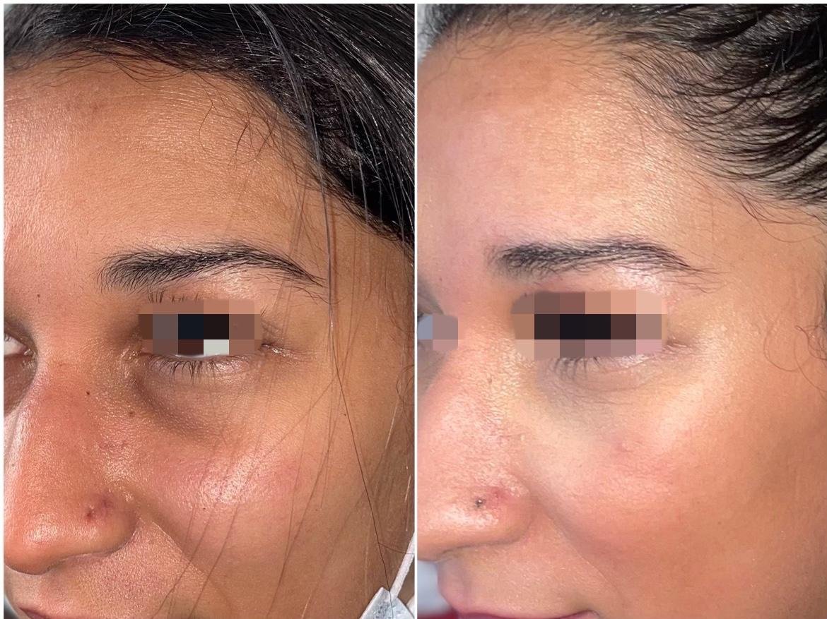 médicine régénérative paris